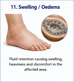 Swelling and oedema management
