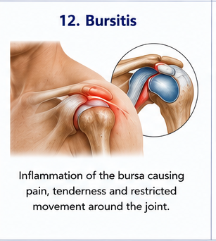 Bursitis pain support
