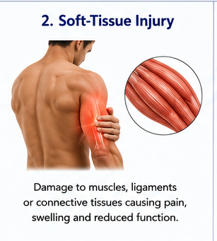 Soft-tissue knee injury and pain