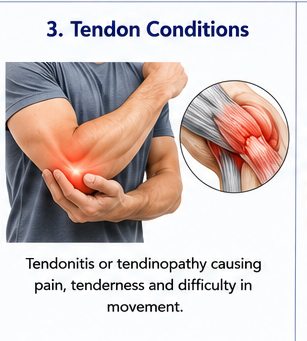 Tendon pain around ankle and foot